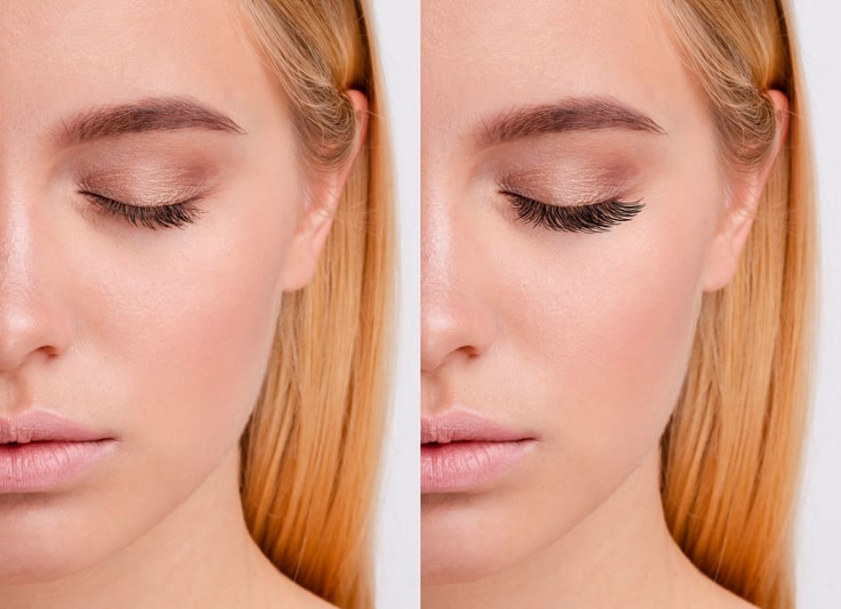 NUTRALASH Trepalnice